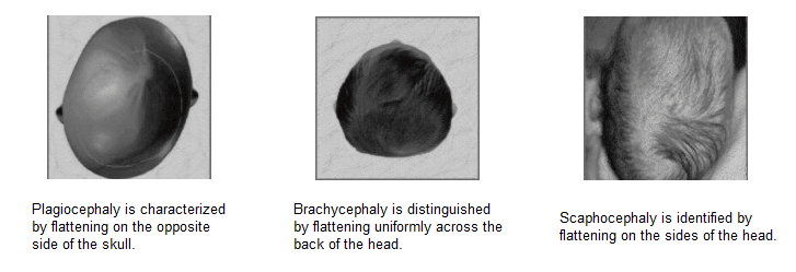 Cranial Helmets